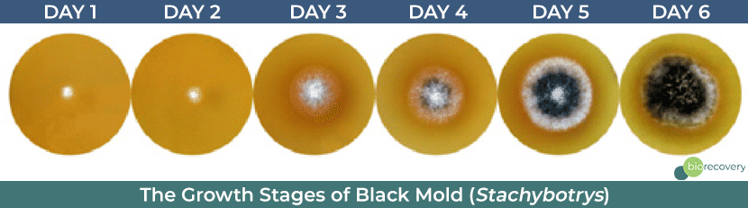 The Growth Stages of Black Mold Stachyboytrs
